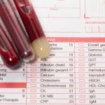 АЛТ/АСТ норма у женщин по возрасту в анализе крови. Таблица обозначений, прямой и непрямой