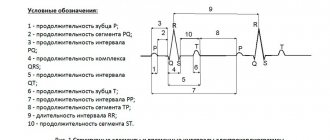 амплитуда сердечных сокращений