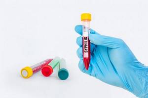анализ крови на сифилис отрицательный