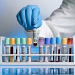 Анализ на протромбиновый индекс