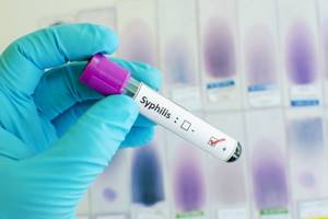 анализ на сифилис положительный