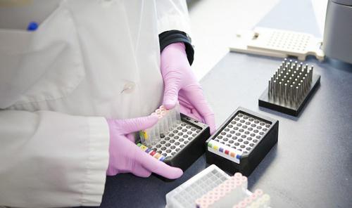 Онкомаркер СА 19-9. Что показывает, означает у мужчин, женщин, норма ...