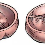 аортальный клапан