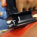 Аритмогенная дисплазия правого желудочка