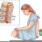 Блокада позвоночника