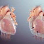 Человеческое сердце