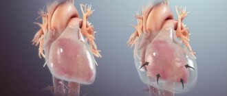 Human heart