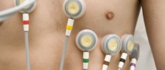 What is heart holter, how is monitoring done, photos, videos, price