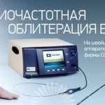 Что такое радиочастотная абляция РЧА