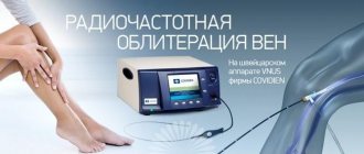 What is radiofrequency ablation RFA