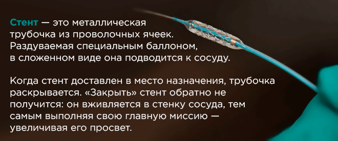 Можно ли после стентирования. Сколько стентов можно поставить в сердце. Стент в сердце после инфаркта срок службы. Стентирование сколько длятся операция. Стенд в сердце сколько живут после операции.