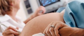 fetal Doppler