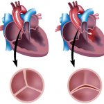 двустворчатый клапан