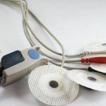 экг показывает инфаркт