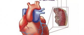эластические свойства миокарда