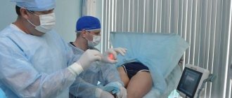 'EVLK - endovasal laser coagulation in "MIFC"' width="400