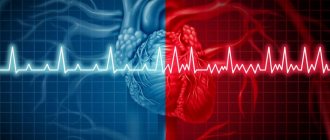 Фибрилляция предсердий: история болезни, клинические рекомендации