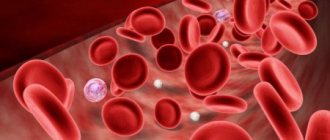 Folate deficiency anemia