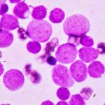 Photography of lymphocytes
