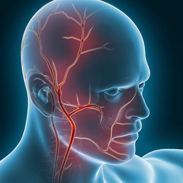 Синдром такаясу классификация. Артерим. Височный артериит этиология. Неспецифический аортоартериит болезнь такаясу. Неспецифический аортоартериит.