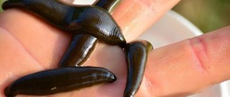 hirudotherapy (treatment with leeches)