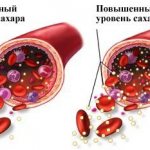 Глюкоза в крови