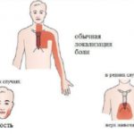 Голова кружится и сердце болит подташнивает