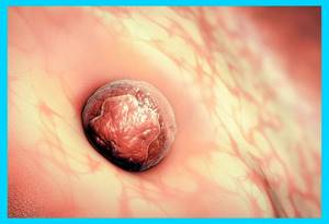 графика имплантации эмбриона человека в стенку матки