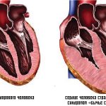 Характеристика болезни