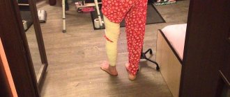 Ходьба после инсульта