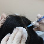 Инъекции для роста волос