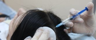 Hair growth injections