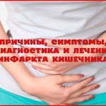Intestinal infarction: causes, symptoms, treatment