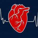 инфаркт миокарда рекомендации