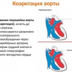Инфографика 1
