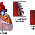 Инфографика
