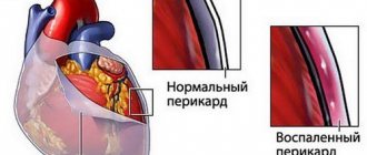 Инфографика