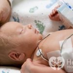 Ишемия у новорожденных - причина развития неврологических заболеваний
