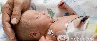 Ишемия у новорожденных - причина развития неврологических заболеваний