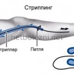 Как делают Стриппинг