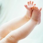 Как определить варикоз на ногах у детей и подростков?