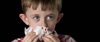 Как правильно остановить кровь из носа у маленьких детей?