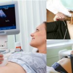 Как прослушать сердцебиение плода