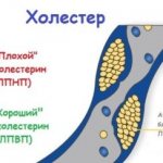 Как пьют льняное масло для понижения холестерина, какая должна быть дозировка, вред и польза продукта