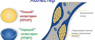 Как пьют льняное масло для понижения холестерина, какая должна быть дозировка, вред и польза продукта