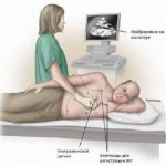 Когда и для чего используют эхокардиографию с допплеровским анализом