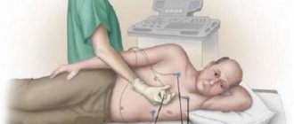 Когда и для чего используют эхокардиографию с допплеровским анализом