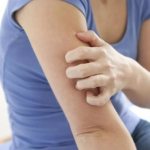 Когда назначают анализ на билирубин