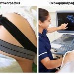 Когда плод нуждается в диагностике ЭХОкг, назначение, особенности проведения, оптимальные сроки и польза, расшифровка