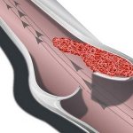 кровь в вене